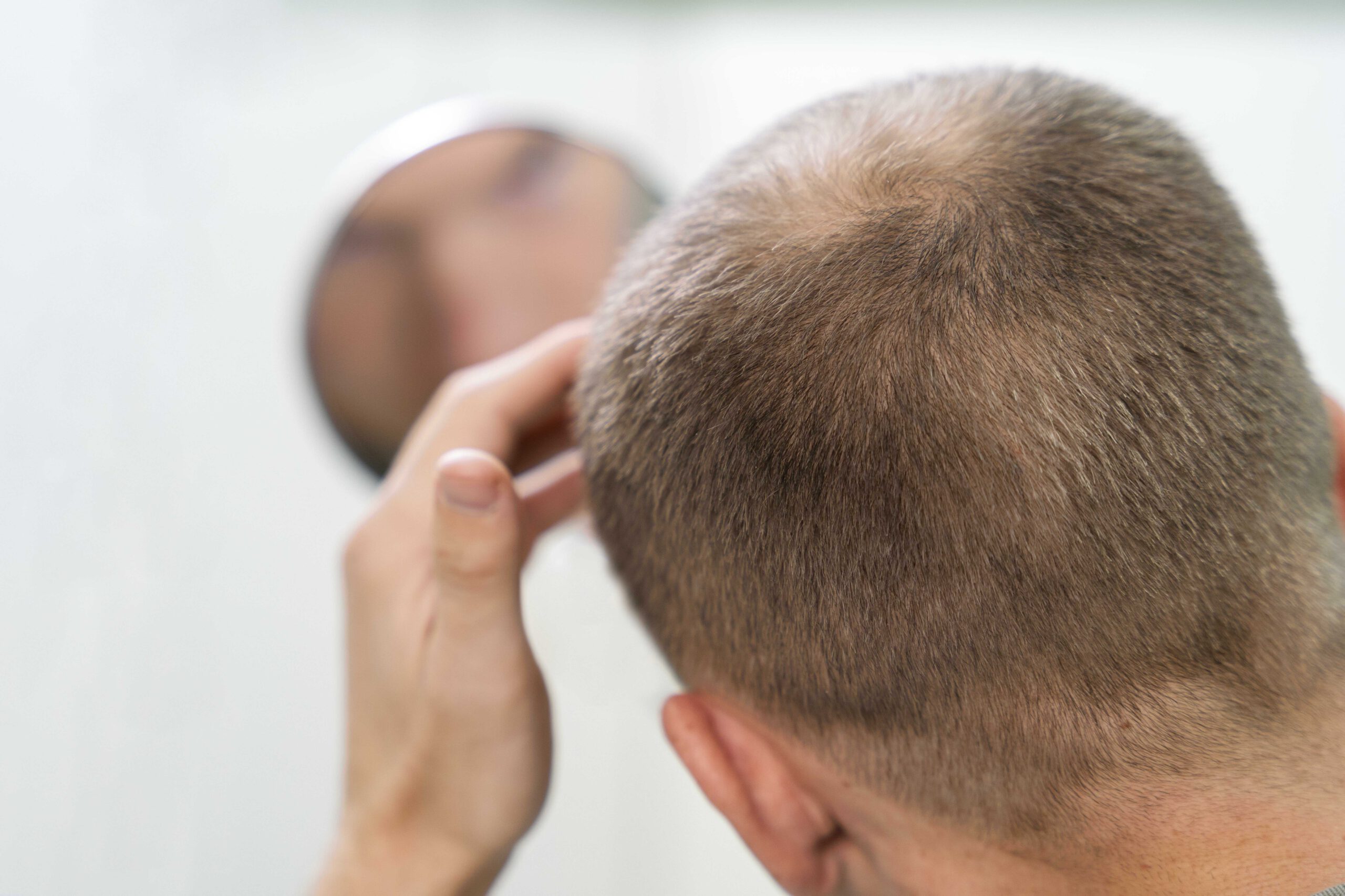 הכל על PRP לשיער: הטיפול המתקדם שמשנה את חיי השיער